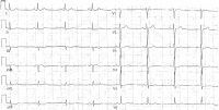 Abbildung 2: Ruhe-EKG