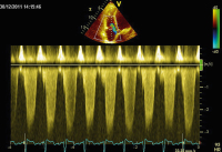 Abbildung 4: CW-Signal