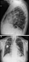 Abbildung 3: Thorax-Röntgen