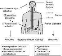 Figure 2: SNS-Überaktivität - Niereninsuffizienz