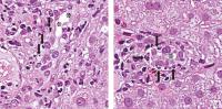 Abbildung 1a-b: Cholestase