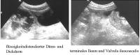 Abbildung 2: Colitis - Diarrhoe