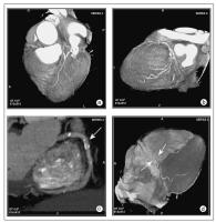 Figure 3a-d: MDCT-Computertomographie