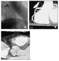 Figure 5a-c: MDCT-Computertomographie