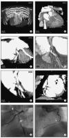 Figure 6a-h: MDCT-Computertomographie