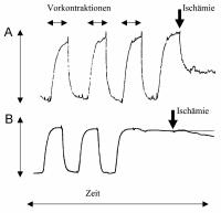 Abbildung 5A-B: Ischämie - Vasodilatation