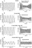 Figure 4A-D: Doxorubicin - Angiotensin-II-Modulation