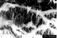 Figure 1: Gefrierschnitt Aorta