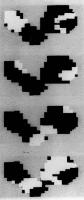 Figure 2: Ventrikuläre Tachykardie