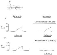 Figure 3: K-Efflux in Koronararterien