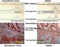Kolonkarzinom - HNPCC-Syndrom