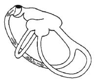 Abbildung 2: Canalolithiasis - Mechanismus