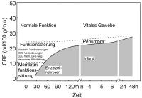 Abbildung 1: Gehirn - Perfusion