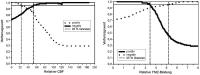 Abbildung 9: Gehirn - Perfusion