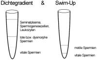 Abbildung 1: Zweistufige Spermienaufbereitung
