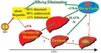 Abbildung 1: Chronische Hepatitis-B-Virusinfektion