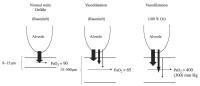 Abbildung 1: Diffusion - Perfusion - Impairment