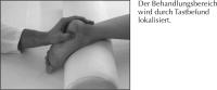 Abbildung 2-a: Radiale extrakorporale Stoßwellentherapie - Fersensporn