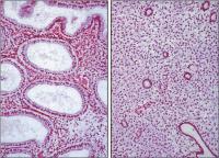 Abbildung 4: Endometrium - Histologie
