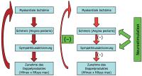 Abbildung 2: Neurostimulation - Schmerz