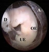 Abbildung 1: Embryo - Scheitel-Steißlage