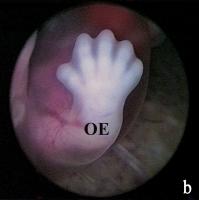 Abbildung 2-b: Embryo - Gesicht - Obere Extremität