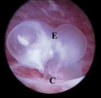 Abbildung 4: GD2-Embryo