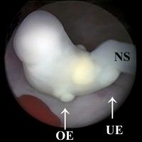Abbildung 5: GD4-Embryo