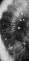 Abbildung 1: Osteoporose - Fallbeispiel