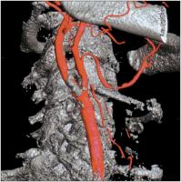 Abbildung 2: 3D-Processing
