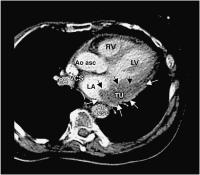 Abbildung 2: Arterielles Multidetektor-CT