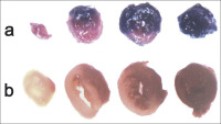 Abbildung 3: TTC-stained heart