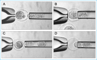 Abbildung 8: Mouse donor embryo