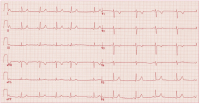 Abbildung 2: EKG