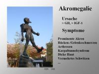 Abbildung 2: Akromegalie - Knochen
