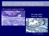 Abbildung 4: Aclasta(R)