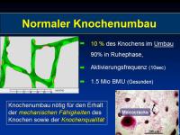Abbildung 5: Osteoporose