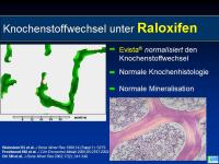 Abbildung 10: Osteoporose