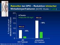 Abbildung 14: Osteoporose