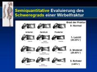 Abbildung 16: Osteoporose
