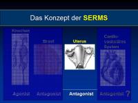 Abbildung 24: Osteoporose