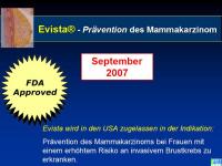 Abbildung 30: Osteoporose