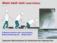 Abbildung 8: Sturz-Risiko-Assessment