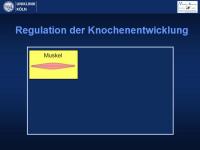 Abbildung 17: Osteogenesis imperfecta