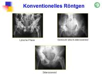 Abbildung 9: Morbus Paget