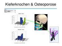 Abbildung 10: Osteologie