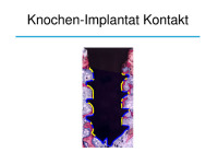 Abbildung 27: Osteologie