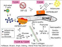 Abbildung 10: Diabetes - Osteoporose