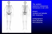 Abbildung 17: Skelettszintigraphie