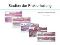 Abbildung 8: Osteoporosetherapie